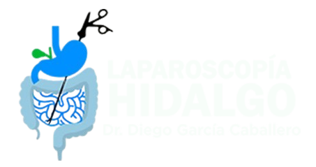Cirugía General y Cirugía Gastrointestinal en Tulancingo, Hidalgo - Dr. Diego García Caballero
