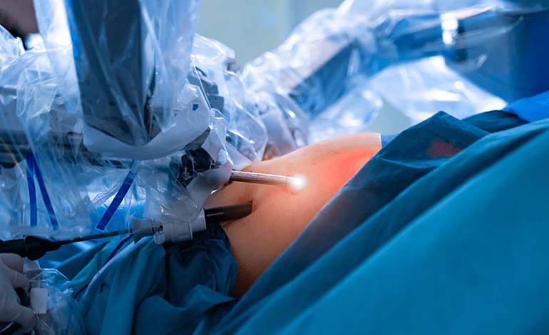 Cirugía de vesícula por laparoscopia