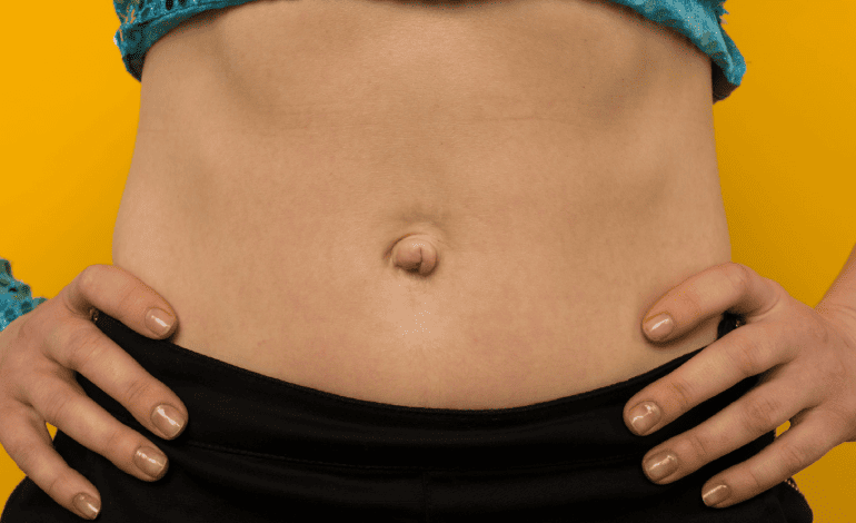 Hernia umbilical en niños y adultos